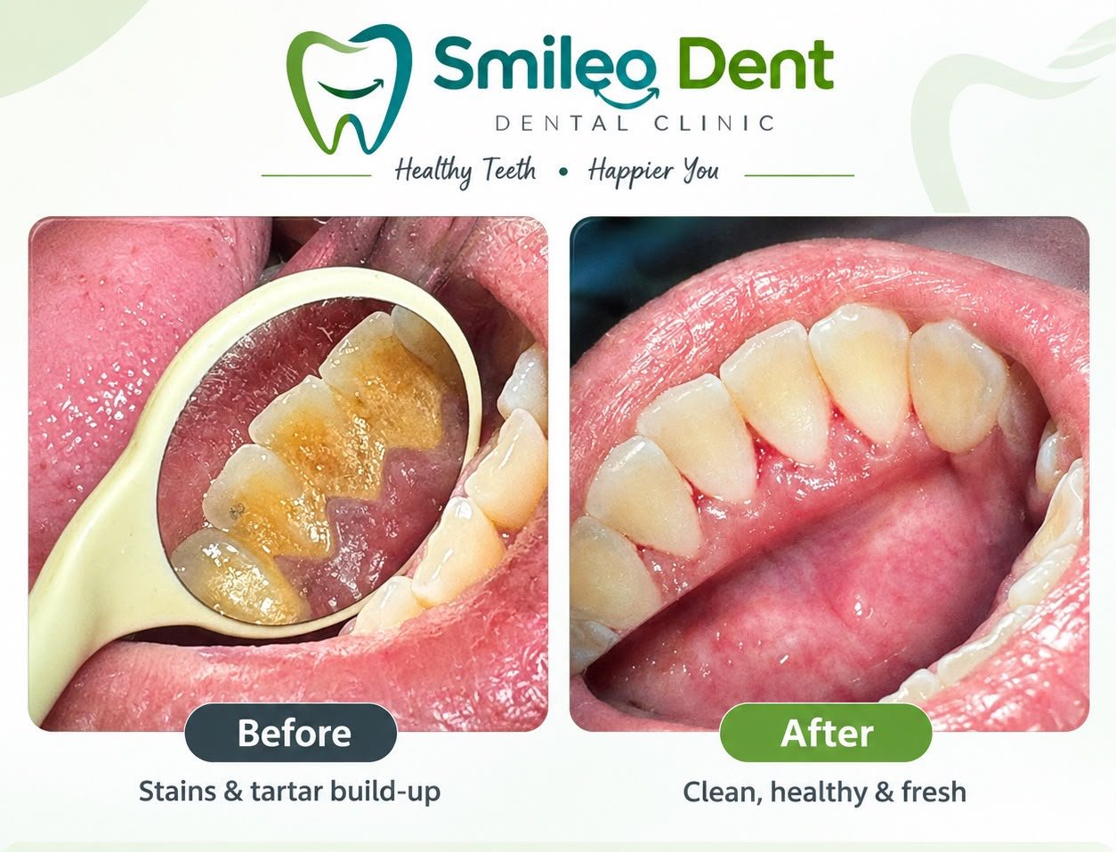 Smile O Dent Dental Care Kolkata